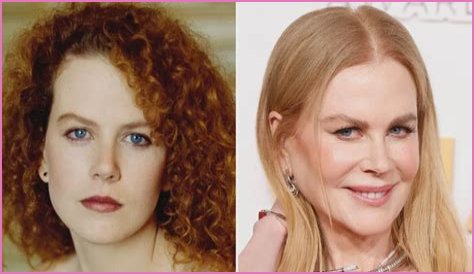 Nicole Kidman's 